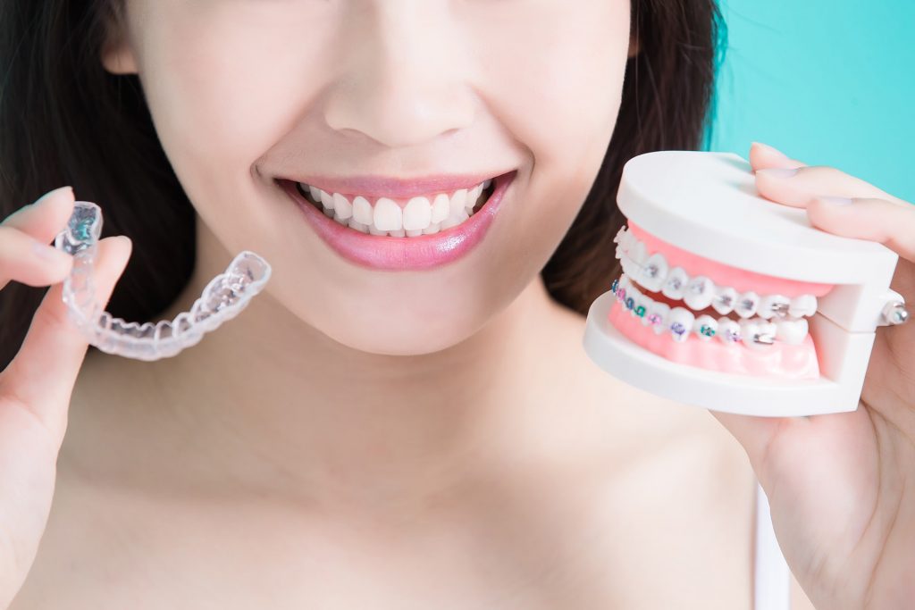 Razones por las que llevar ortodoncia