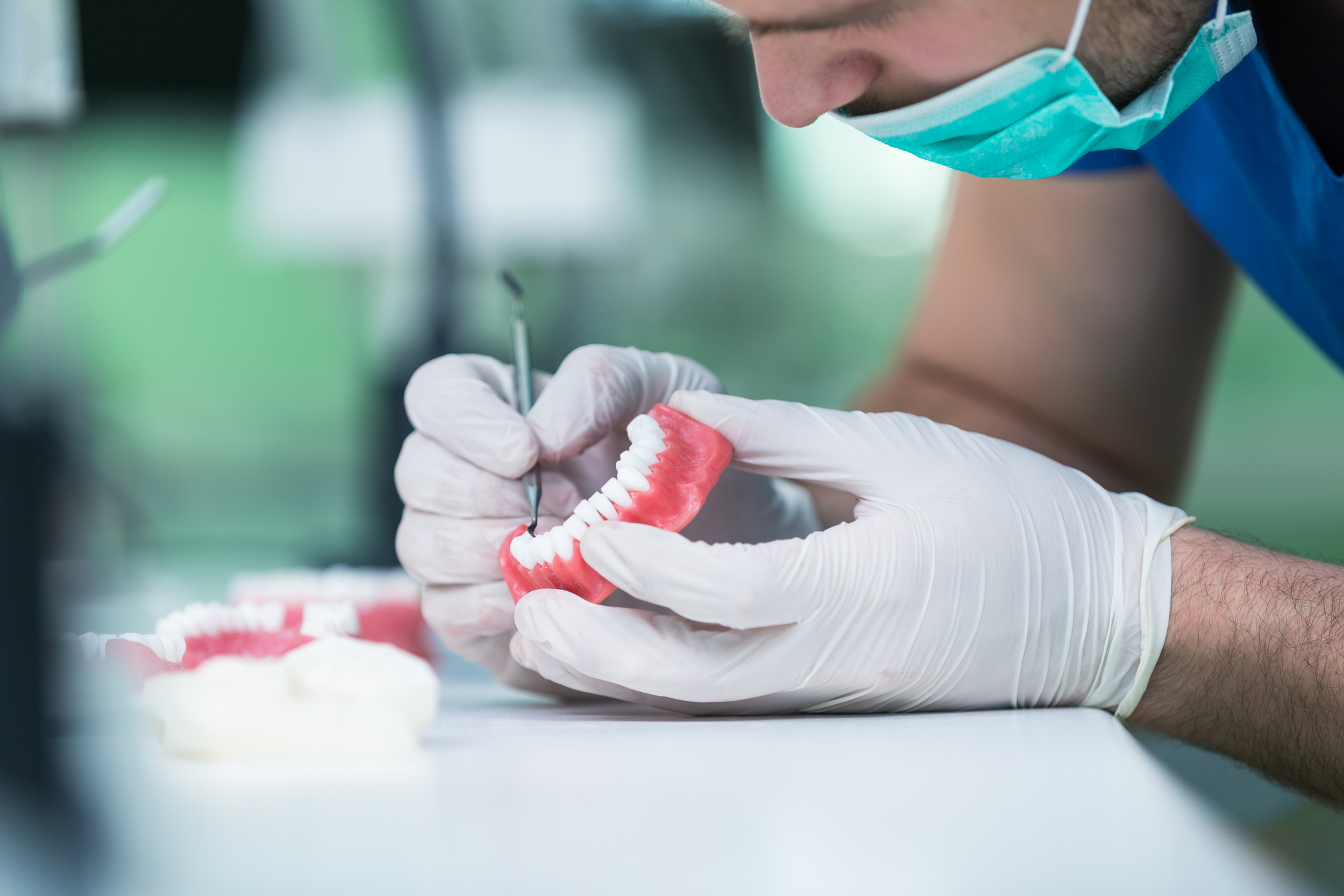 implantes dentales en Segovia